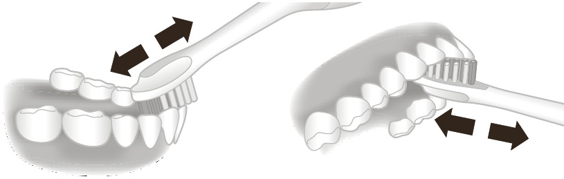 Philips - DiamondClean 9000 - Verwendung - Putzanleitung - Schritt 3 Verwendung - Putzanleitung - Schritt 3
