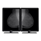 Barco Nio 5MP LED