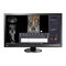Eizo Radiforce MX270W