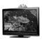 LED-Fernseher Medion LifeP12037 Bedienungsanleitung